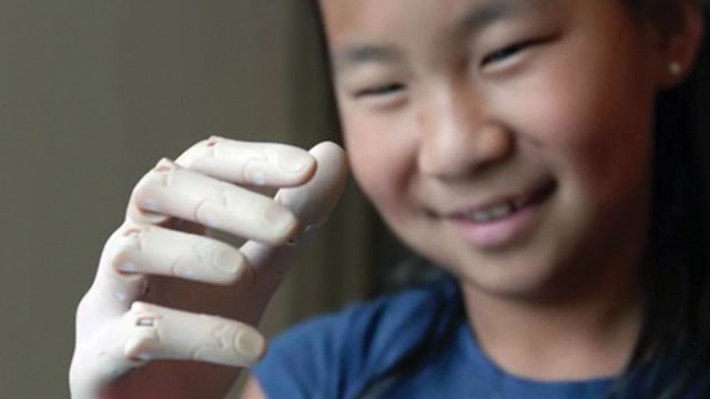 The digital twin enables a revolution in prosthetics, as this young girl demonstrates with her hand.