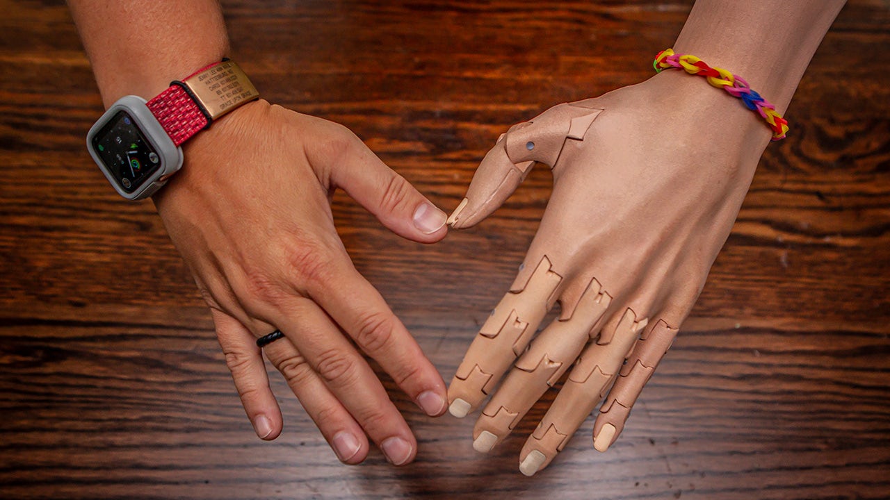 revolution-in-prosthetics-ut-36-heart-hands-dark-1280x720